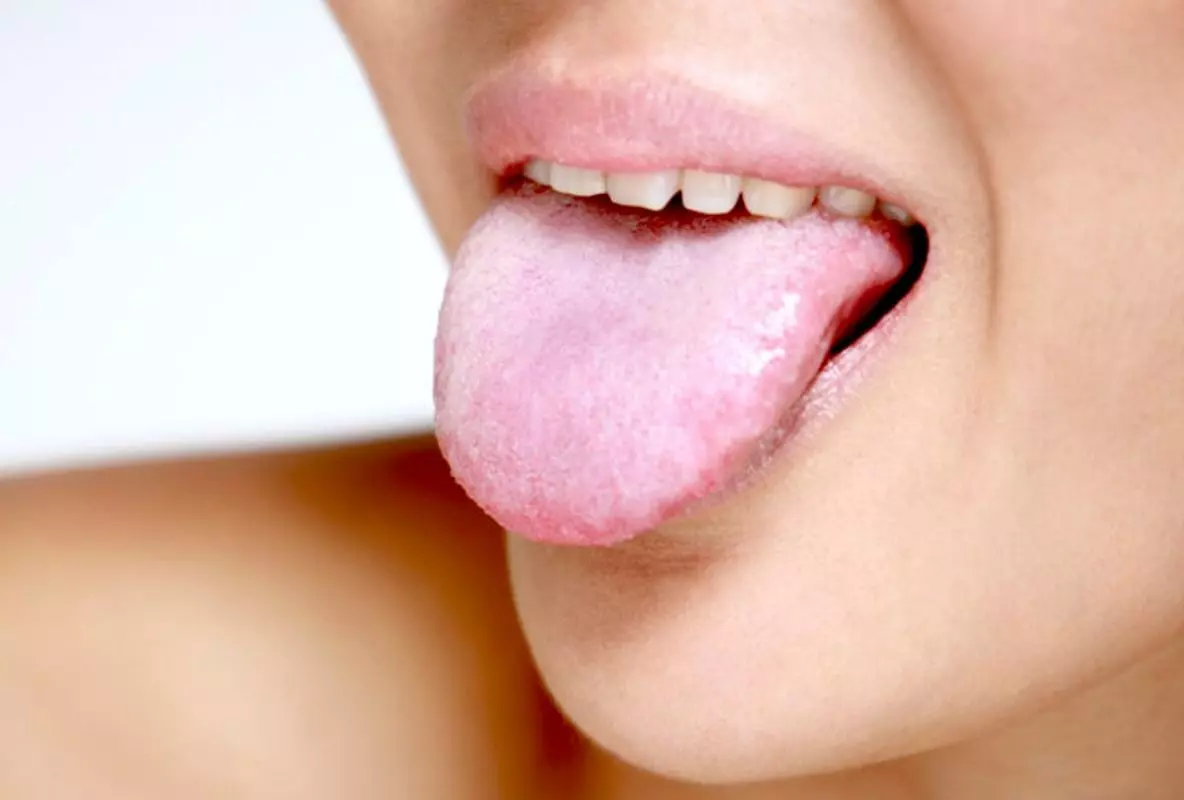 Кандидоз полости рта: распознать и предотвратить!